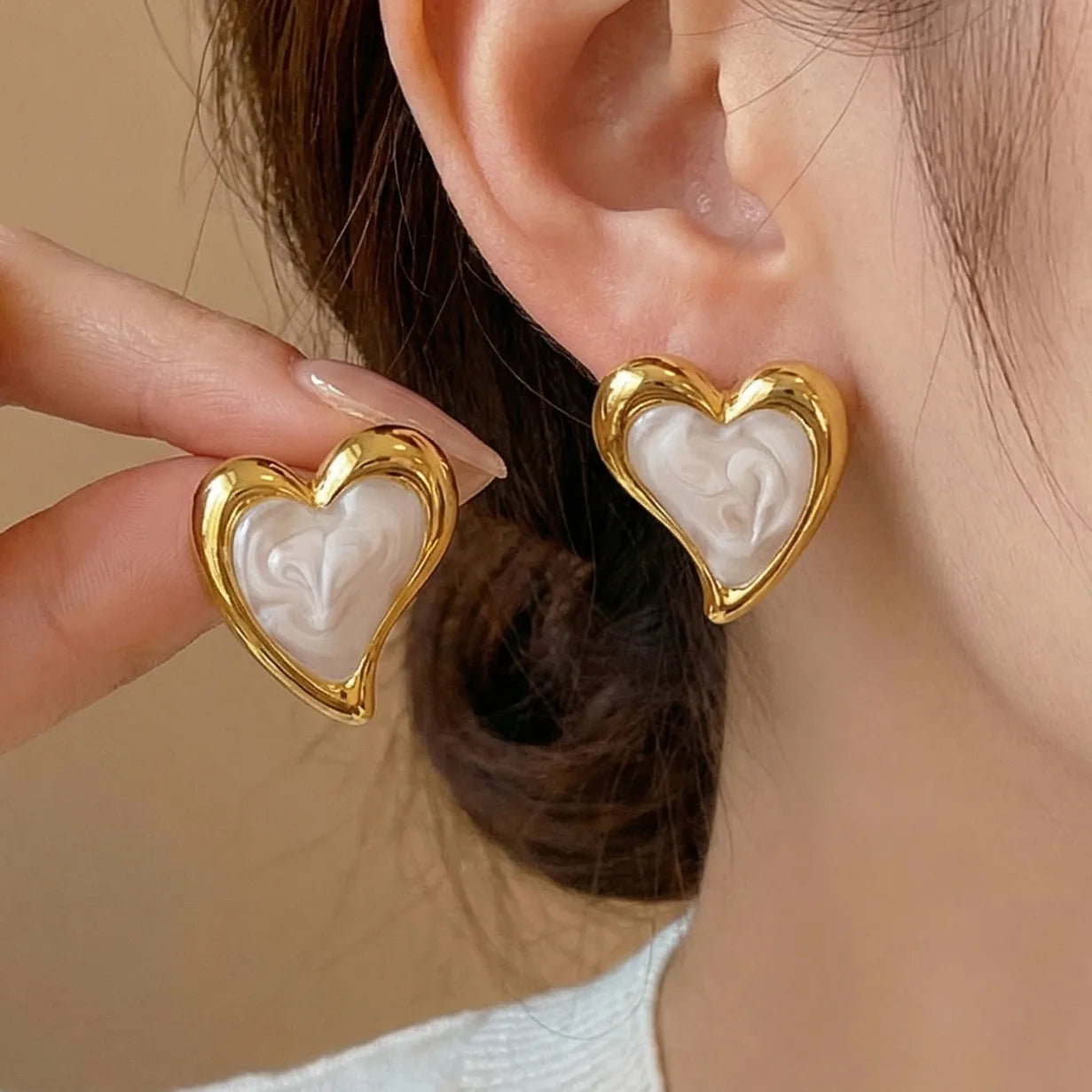 Aretes