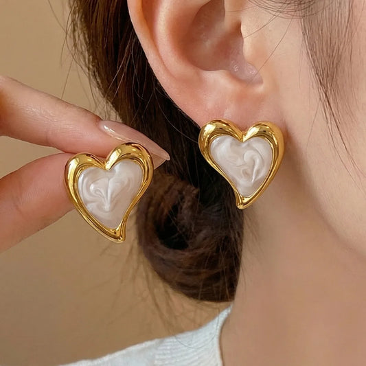 Aretes