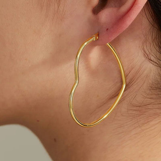 Aretes